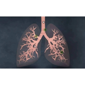 天津体检中心丨引发肺癌的坏习惯是哪些